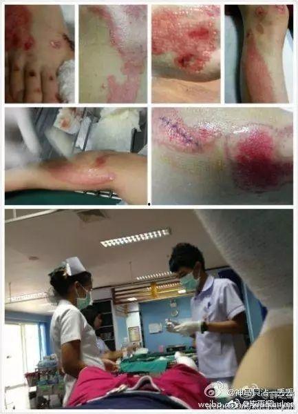 娱乐圈近期爆料谁出车祸,某明星不幸遭遇车祸，伤情严重！